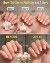 Revive Your Nails With a Simple Garlic Secret