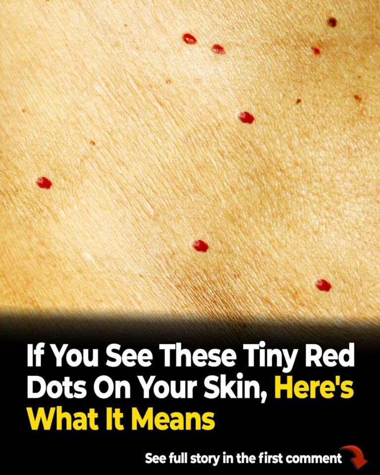 Noticing Tiny Red Dots on Your Skin? Here’s What a Dermatologist Wants You to Know