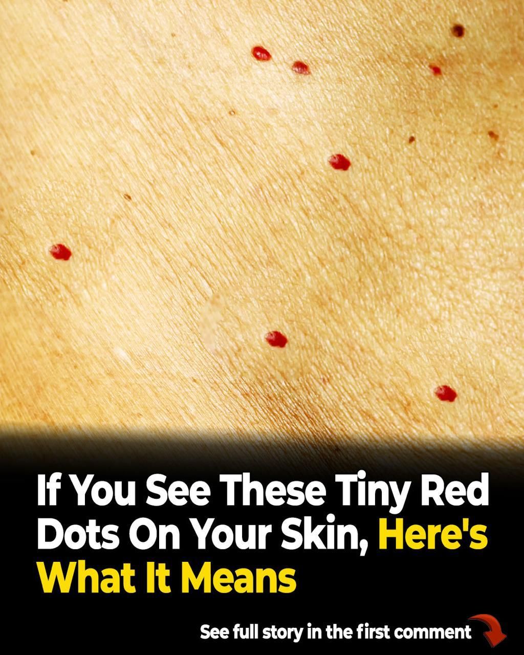 Noticing Tiny Red Dots on Your Skin? Here’s What a Dermatologist Wants You to Know